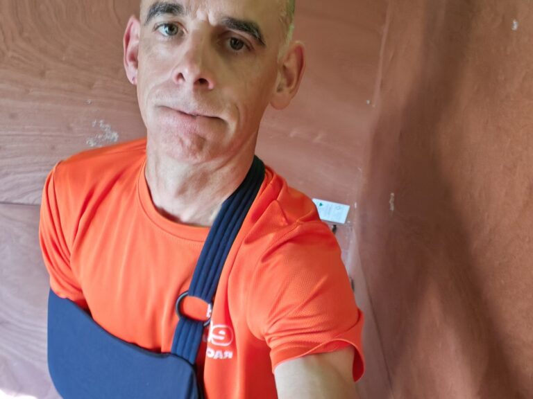 Richard Davison with his left arm in a navy sling after AC joint reconstruction.